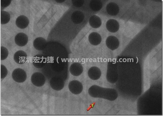 BGA因為焊墊變小，造成錫膏過多而最終形成焊接短路的結(jié)果。